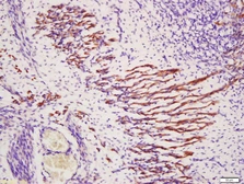 Anti-TXLNB antibody used in IHC (Paraffin sections) (IHC-P). GTX51247