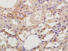 Anti-DIAPH2 antibody used in IHC (Paraffin sections) (IHC-P). GTX51331