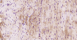 Anti-FLNC antibody used in IHC (Paraffin sections) (IHC-P). GTX51350