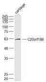 Anti-C20orf186 antibody used in Western Blot (WB). GTX51455