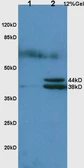 Anti-Haptoglobin antibody used in Western Blot (WB). GTX51524