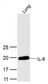 Anti-IL9 antibody used in Western Blot (WB). GTX51537