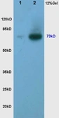 Anti-TORC2 (phospho Ser171) antibody used in Western Blot (WB). GTX51565