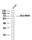 Anti-CD92 antibody used in Western Blot (WB). GTX51574