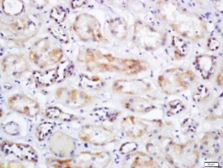 Anti-SLC25A10 antibody used in IHC (Paraffin sections) (IHC-P). GTX51583