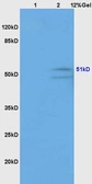 Anti-GABA A Receptor gamma 2 antibody used in Western Blot (WB). GTX51587