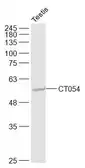 Anti-SLC52A3 antibody used in Western Blot (WB). GTX51591