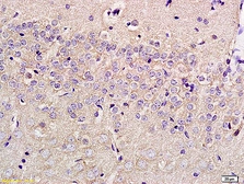 Anti-SLC29A4 antibody used in IHC (Paraffin sections) (IHC-P). GTX51592