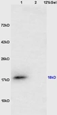 Anti-CTAG1B antibody used in Western Blot (WB). GTX51601
