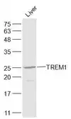 Anti-TREM1 antibody used in Western Blot (WB). GTX51612