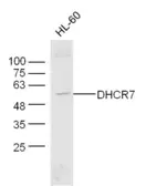 Anti-DHCR7 antibody used in Western Blot (WB). GTX51622