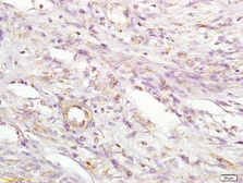 Anti-MIIP antibody used in IHC (Paraffin sections) (IHC-P). GTX51659