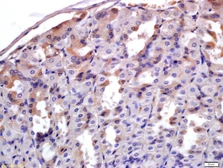 Anti-ADAM28 antibody used in IHC (Paraffin sections) (IHC-P). GTX51662