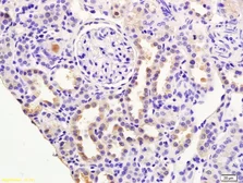 Anti-RASSF3 antibody used in IHC (Paraffin sections) (IHC-P). GTX51688
