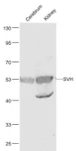Anti-SVH antibody used in Western Blot (WB). GTX51744