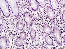 Anti-CTAG2 antibody used in IHC (Paraffin sections) (IHC-P). GTX51753