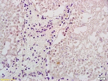 Anti-ELL2 antibody used in IHC (Paraffin sections) (IHC-P). GTX51778