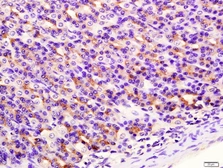Anti-SIRT4 antibody used in IHC (Paraffin sections) (IHC-P). GTX51798
