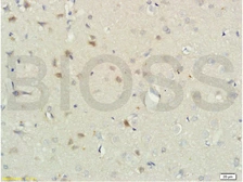 Anti-RNF122 antibody used in IHC (Paraffin sections) (IHC-P). GTX51802