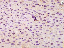 Anti-SRRM2 antibody used in IHC (Paraffin sections) (IHC-P). GTX51871