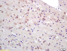 Anti-CCDC12 antibody used in IHC (Paraffin sections) (IHC-P). GTX51891