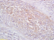Anti-FRMD6 antibody used in IHC (Paraffin sections) (IHC-P). GTX51938