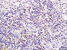 Anti-SPP24 antibody used in IHC (Paraffin sections) (IHC-P). GTX51998