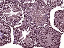 Anti-CDC14A antibody used in IHC (Paraffin sections) (IHC-P). GTX52005