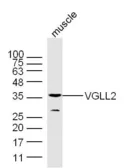 Anti-VGLL2 antibody used in Western Blot (WB). GTX52051