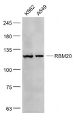 Anti-RBM20 antibody used in Western Blot (WB). GTX52196