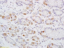 Anti-DENND2D antibody used in IHC (Paraffin sections) (IHC-P). GTX52212