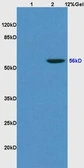 Anti-KLF4 antibody used in Western Blot (WB). GTX52307