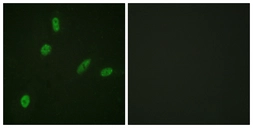 Anti-ETS1 antibody used in Immunocytochemistry/ Immunofluorescence (ICC/IF). GTX52308