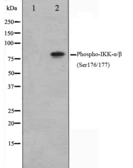 Anti-IKK alpha (phospho Ser176) + IKK beta (phospho Ser177) antibody used in Western Blot (WB). GTX52310
