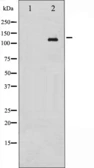Anti-c-Abl (phospho Tyr412) antibody used in Western Blot (WB). GTX52311