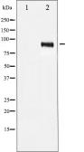 Anti-IGF1R (phospho Tyr1131) / Insulin Receptor (phospho Tyr1146) antibody used in Western Blot (WB). GTX52315