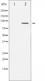 Anti-PKC alpha (phospho Thr497) antibody used in Western Blot (WB). GTX52316