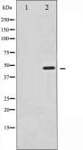 Anti-Synaptotagmin 1 (phospho Ser312) + Synaptotagmin 2 (phospho Ser309) antibody used in Western Blot (WB). GTX52317
