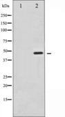 Anti-Synaptotagmin 1 (phospho Ser312) + Synaptotagmin 2 (phospho Ser309) antibody used in Western Blot (WB). GTX52317