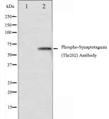 Anti-Synaptotagmin 1 (phospho Thr202) + Synaptotagmin 2 (phospho Thr199) antibody used in Western Blot (WB). GTX52318