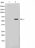 Anti-AKT (phospho Thr308) antibody used in Western Blot (WB). GTX52321