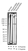 Anti-AHR (phospho Ser36) antibody used in Western Blot (WB). GTX52324