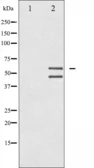 Anti-JNK (phospho Thr183/Tyr185) antibody used in Western Blot (WB). GTX52326
