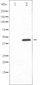 Anti-JNK (phospho Tyr185) antibody used in Western Blot (WB). GTX52328