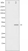 Anti-CCR5 (phospho Ser336) antibody used in Western Blot (WB). GTX52329