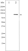 Anti-STAT5B (phospho Ser731) antibody used in Western Blot (WB). GTX52330