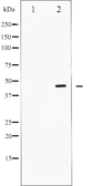 Anti-SMAD2 (phospho Thr8) antibody used in Western Blot (WB). GTX52335