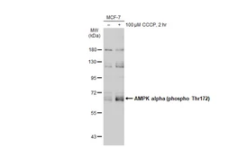 Anti-AMPK alpha 1 (phospho Thr183) + AMPK alpha 2 (phospho Thr172) antibody used in Western Blot (WB). GTX52341