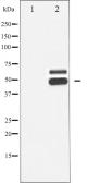 Anti-CaMK2 beta/ gamma/ delta (phospho Thr287) antibody used in Western Blot (WB). GTX52342