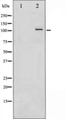 Anti-PKC mu (phospho Ser738 / Ser742) antibody used in Western Blot (WB). GTX52343